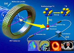 IMAGING MOLECOLARE IMAGING MOLECOLARE