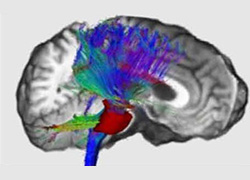 NEUROIMAGING NEUROIMAGING